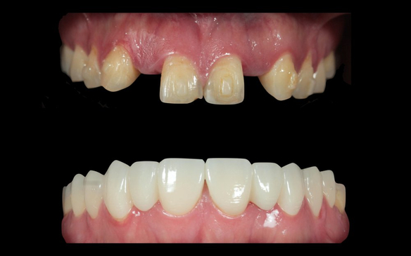 Slider image (5) Art Dental Care